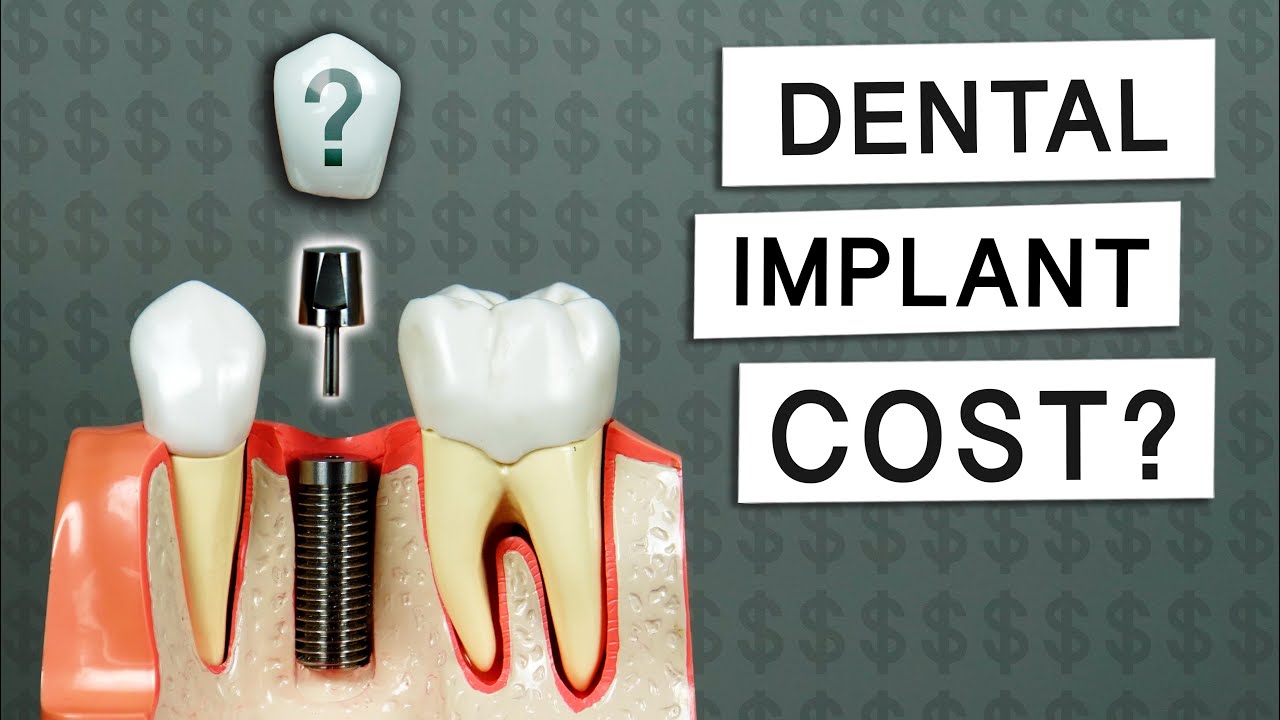dental-implant-cost-in-jaipur